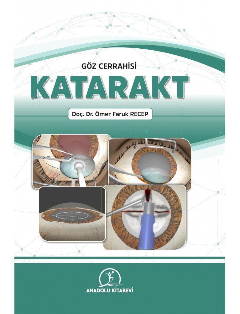 GÖZ CERRAHİSİ KATARAKT