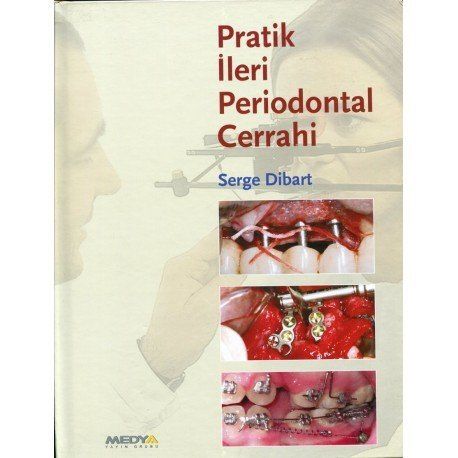 Pratik İleri Periodontal Cerrahi
